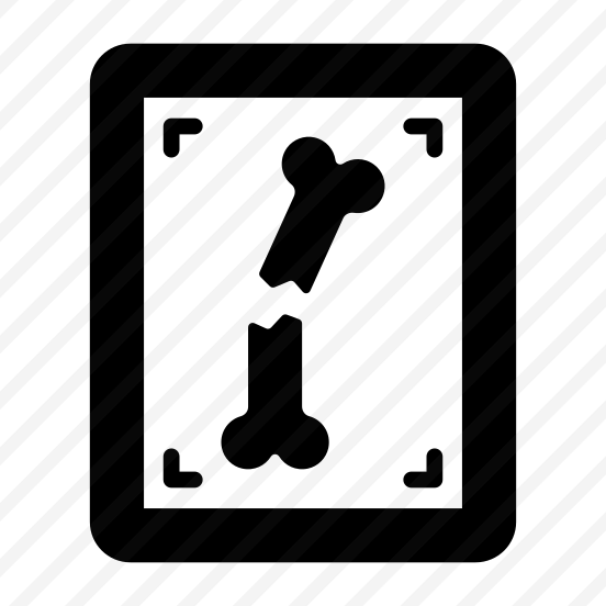 Radiology, Screening, Examination, Fracture, Bone preview