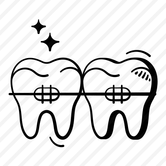 Dental, Braces, Teeth, Orthodontics, Health, preview