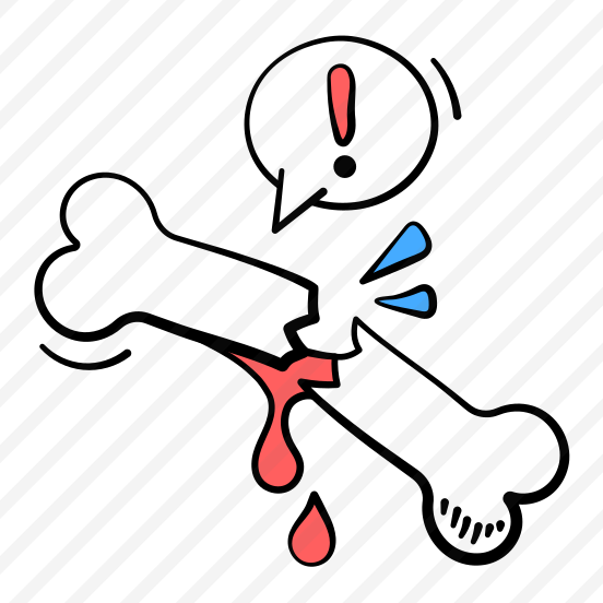 Bone, Fracture, Injury, Trauma, Orthopedic preview