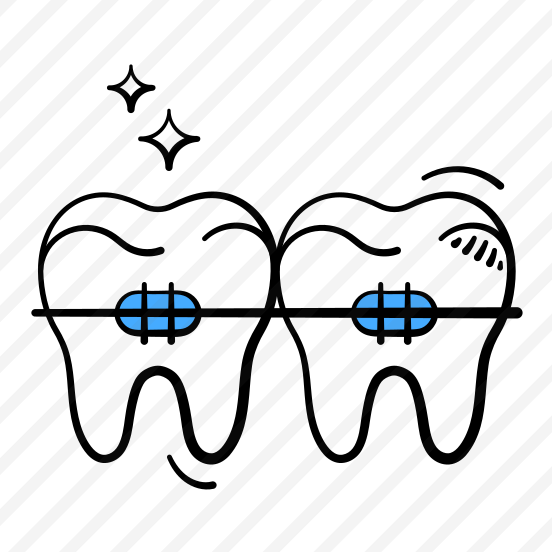 Dental, Braces, Teeth, Orthodontics, Health,,,,, preview