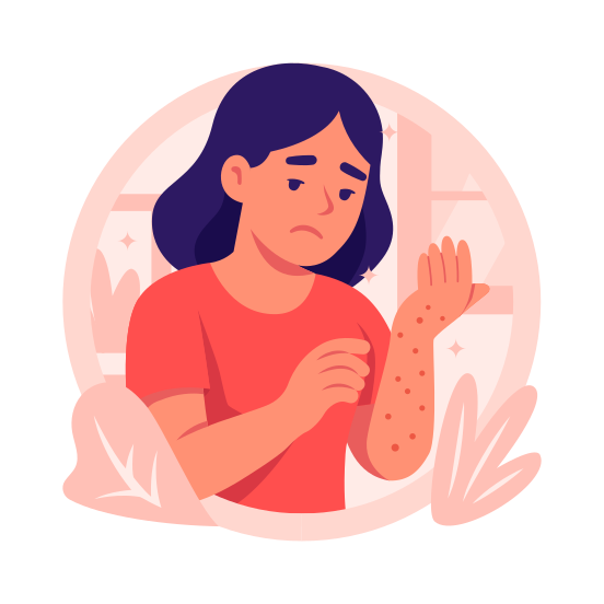 Skin, Allergy, Skincare, Dermatology, Eczema, Allergic, illustration