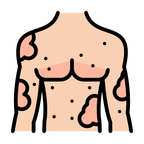 Allergy, Dermatitis, Skin, Skin Allergy, Disease  icon