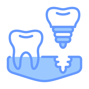 Dental Implant, Dental, Screw, Tooth, Molar, Implant  icon