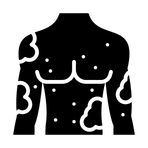 Allergy, Dermatitis, Skin, Skin Allergy, Disease  icon