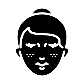 Freckles, Woman, Face, Spot, Skin  icon