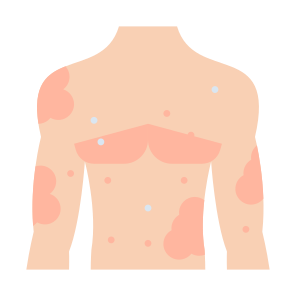 Allergy, Dermatitis, Skin, Skin Allergy, Disease  icon