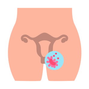 Ovarian Cancer, Cancer, Organ, Uterus, Ovaries icon