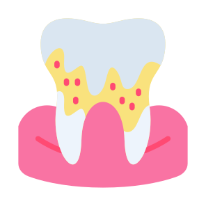 Dental Calculus, Calculus, Tartar, Dental Care, Dental, Tooth icon