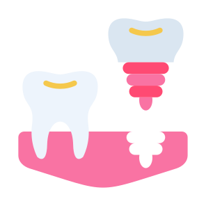 Dental Implant, Dental, Screw, Tooth, Molar, Implant  icon