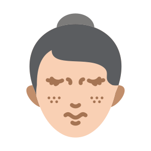 Freckles, Woman, Face, Spot, Skin  icon