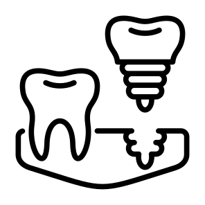 Dental Implant, Dental, Screw, Tooth, Molar, Implant  icon