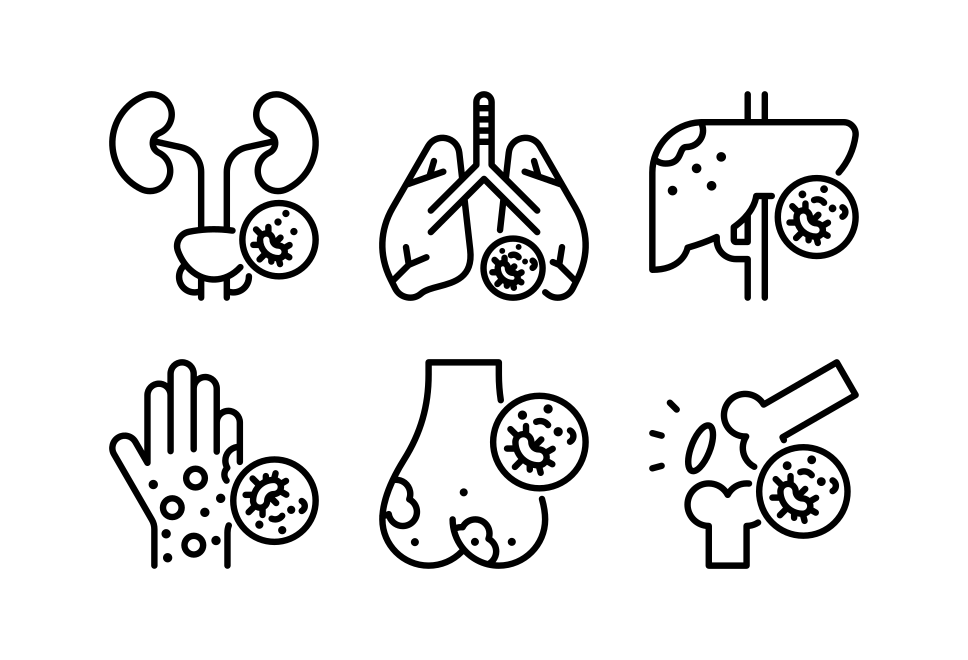Cancer Diagnosis Large Set Preview