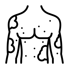 Allergy, Dermatitis, Skin, Skin Allergy, Disease  icon